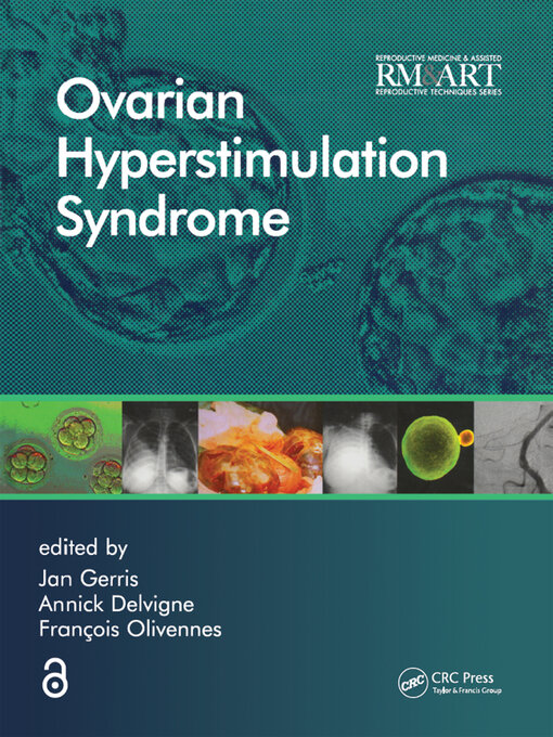 Title details for Ovarian Hyperstimulation Syndrome by Jan Gerris - Wait list
